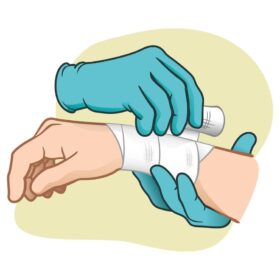 PANSEMENTS COMPLEXES ET DISPOSITIFS MÉDICAUX ASSOCIÉS