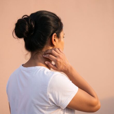 LA DERMATITE ATOPIQUE